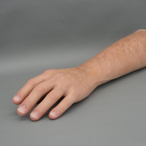 Diferencias entre prótesis estética y funcional