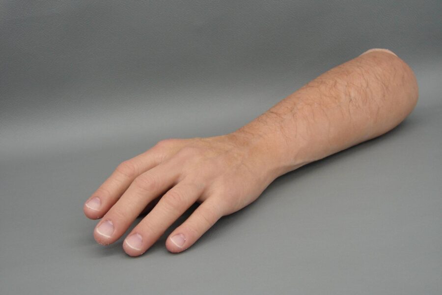 Diferencias entre prótesis estética y funcional