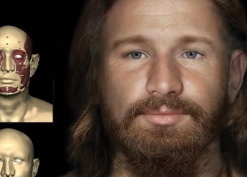 reconstrucción facial