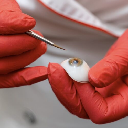 Prótesis oculares con movimiento