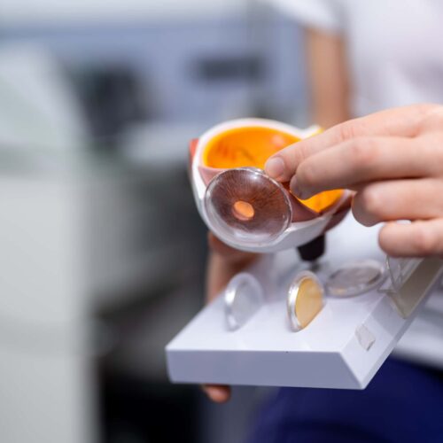 limpieza de protesis ocular