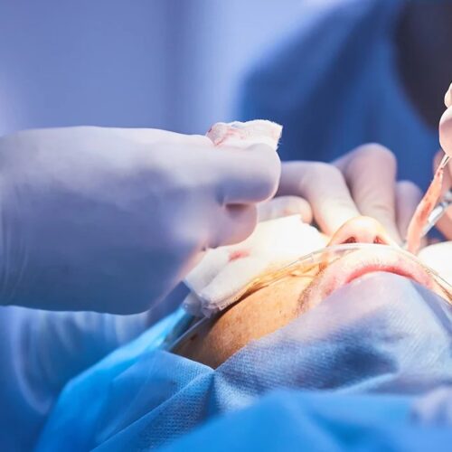 Reconstrucción facial postraumática