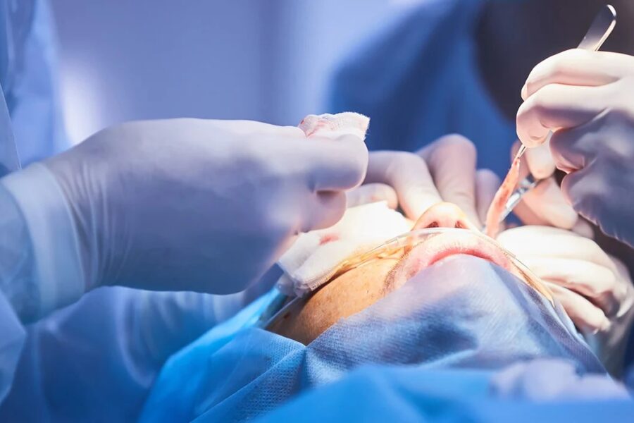 Reconstrucción facial postraumática