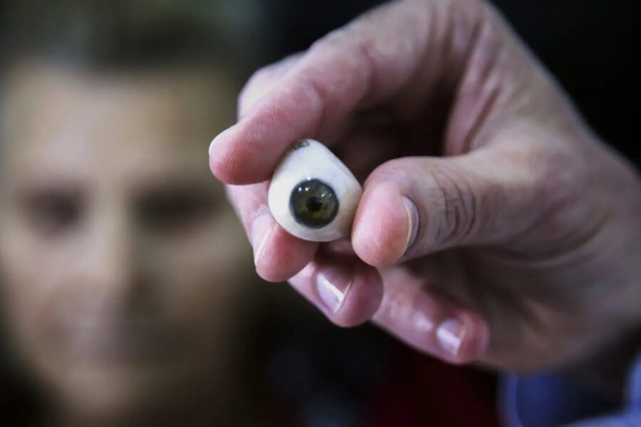 famosos con prótesis ocular