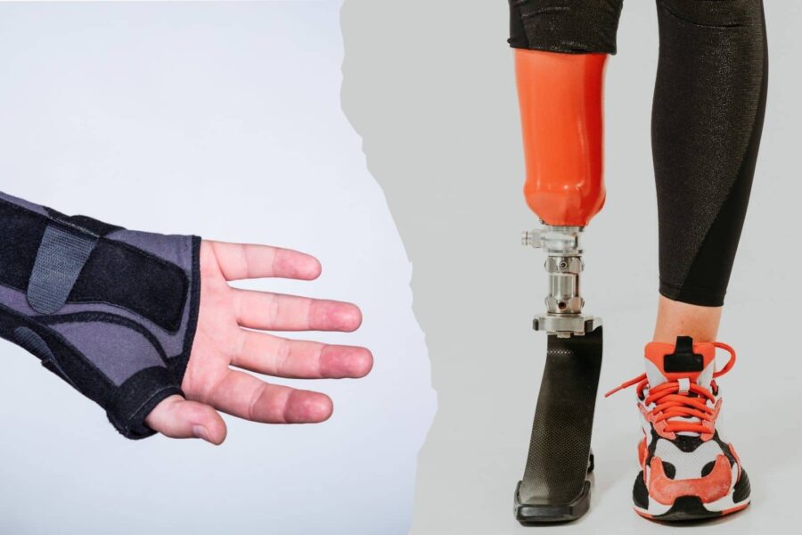 Diferencias entre ortesis y prótesis