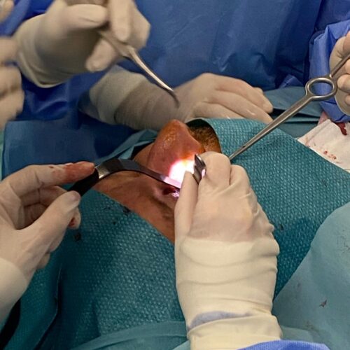 Laboratorio de anatomoplastología en Huesca