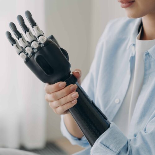 prótesis funcional y prótesis estética