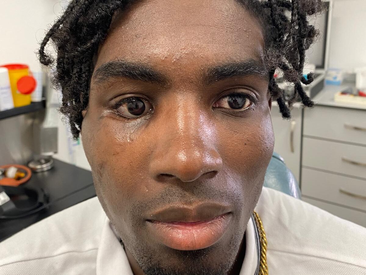 Reconstrucción postraumática