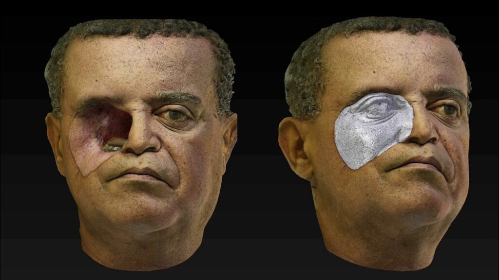 Materiales usados en prótesis facial