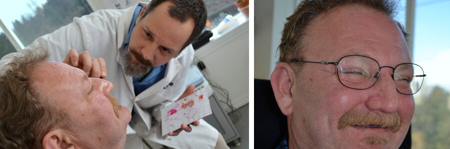 llevar una prótesis facial