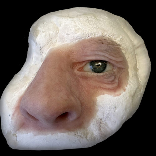 Qué es una prótesis facial