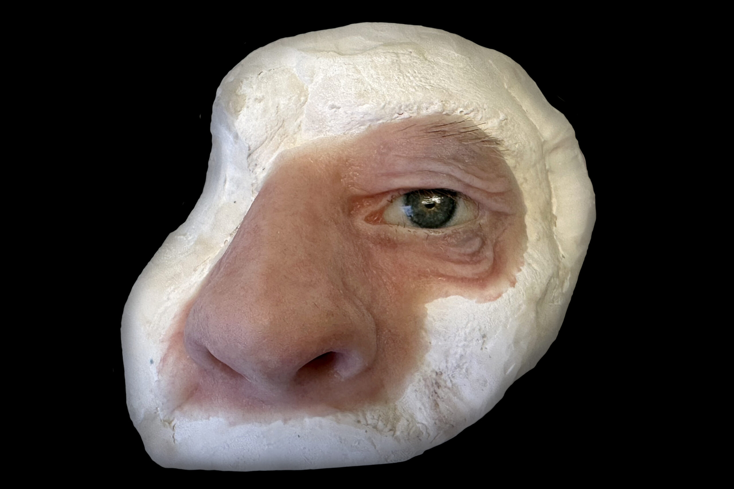 Qué es una prótesis facial